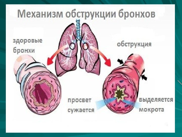 Когда болит печень симптомы бронхита