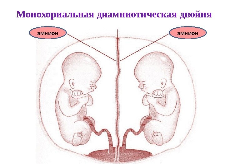  отсутствует ткань хориона. Монохориальная диамниотическая двойня амнион 