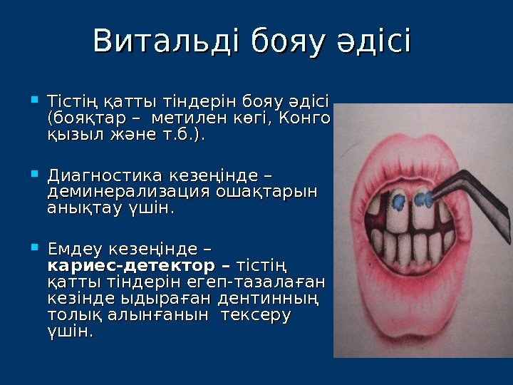 Витальді бояу әдісі  Тістің қатты тіндерін бояу әдісі (бояқтар – метилен көгі, Конго