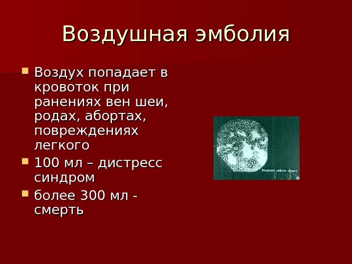   Воздушная эмболия Воздух попадает в кровоток при ранениях вен шеи,  родах,