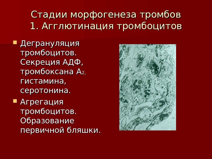   Стадии морфогенеза тромбов 1. Агглютинация тромбоцитов Дегрануляция тромбоцитов.  Секреция АДФ, 