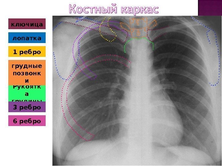 ключица 6 ребро. Рукоятк а грудины грудные позвонк илопатка 3 ребро 1 ребро 