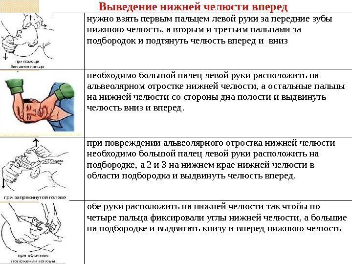 нужно взять первым пальцем левой руки за передние зубы нижнюю челюсть, а вторым и