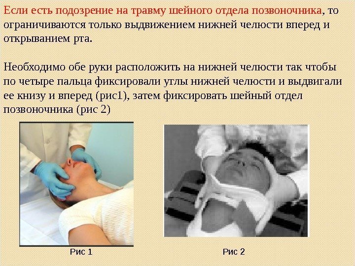 Если есть подозрение на травму шейного отдела позвоночника , то ограничиваются только выдвижением нижней