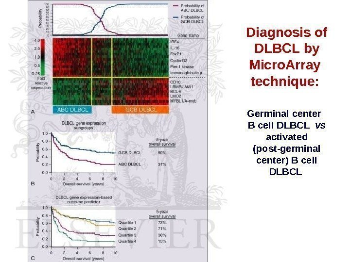 Diagnosis of DLBCL by Micro. Array  technique:  Germinal center  B cell