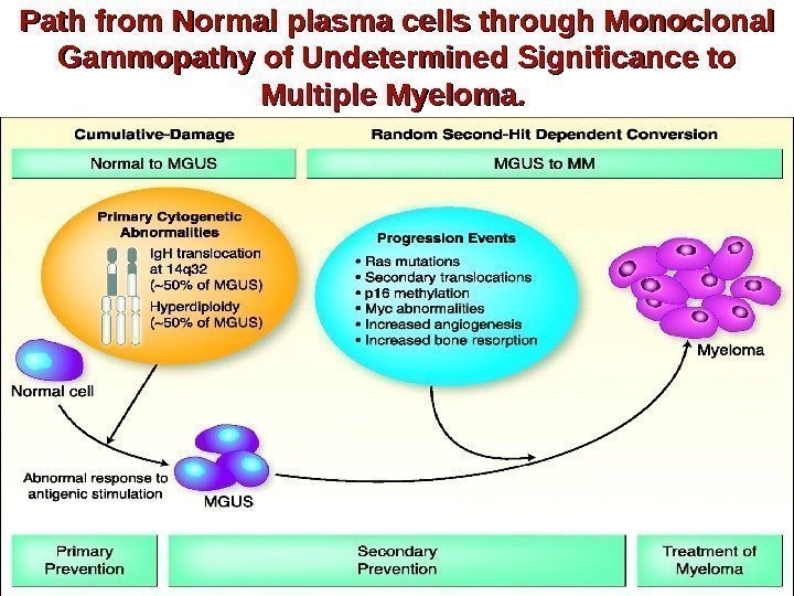 Path from Normal plasma cells through Monoclonal Gammopathy of Undetermined Significance to Multiple Myeloma.