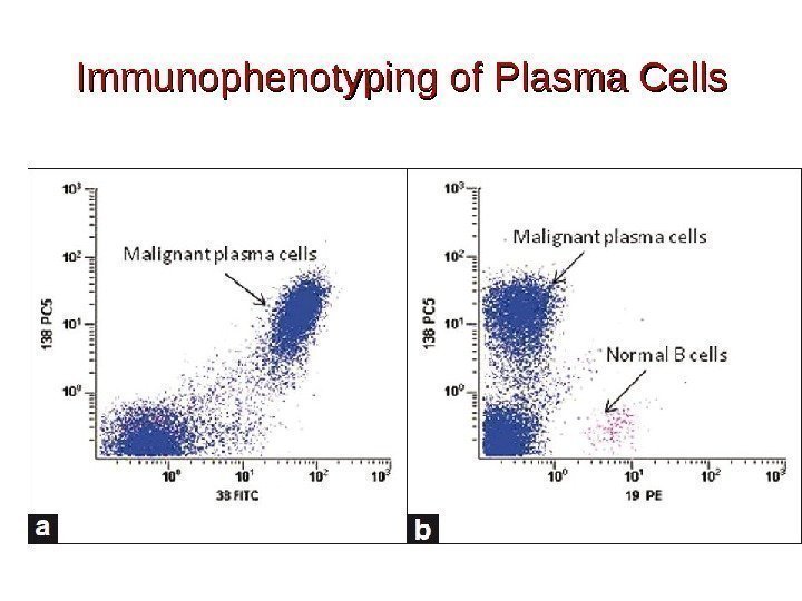 Immunophenotyping of Plasma Cells 
