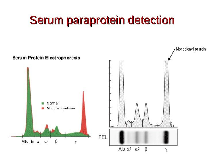 Serum paraprotein detection 