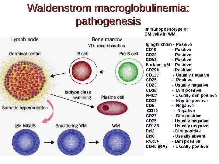 Waldenstrom macroglobulinemia:  pathogenesis Immunophenotype of BM cells in WM Ig light chain -