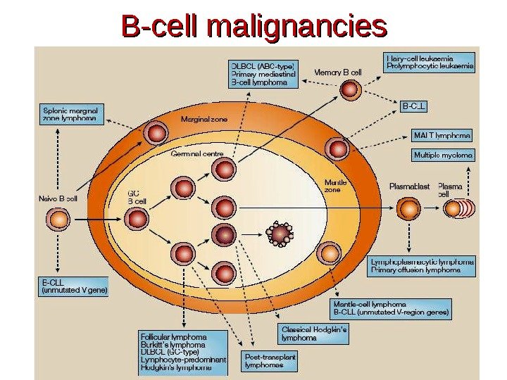 B-cell malignancies 