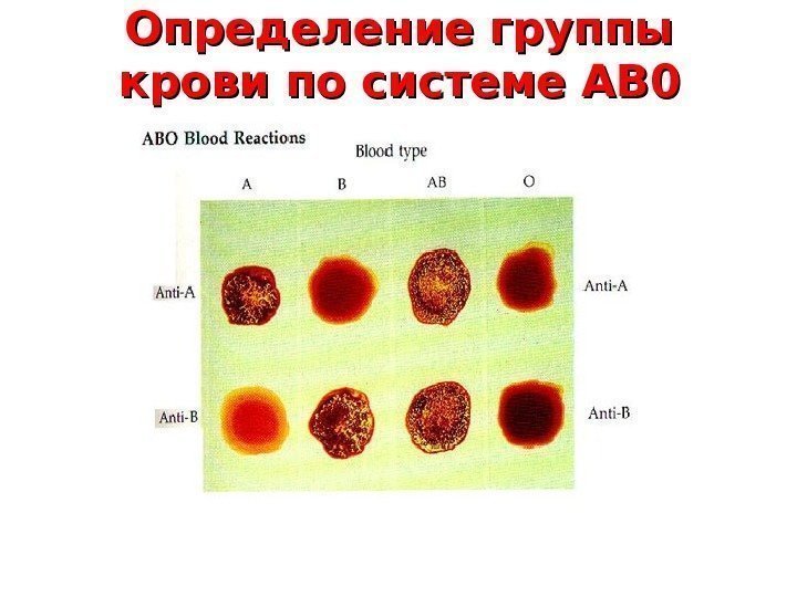 Определение группы крови по системе АВ 00 