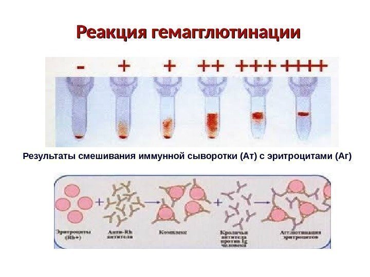 Реакция гемагглютинации Результаты смешивания иммунной сыворотки (Ат) с эритроцитами (Аг) 
