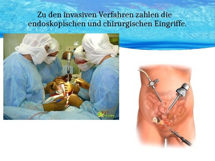 Zu den invasiven Verfahren zahlen die endoskopischen und chirurgischen Eingriffe. 