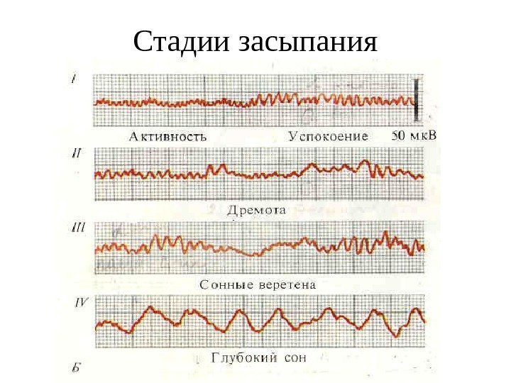 Стадии засыпания 