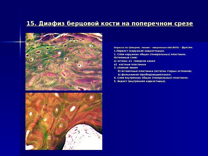 15. Диафиз берцовой кости на поперечном срезе Окраска по Шморлю, тионин – пикриновая 