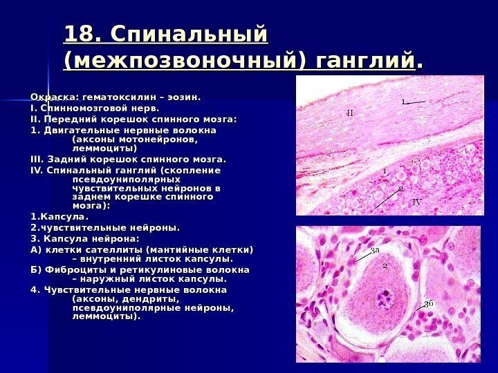 18. Спинальный (межпозвоночный) ганглий. . Окраска: гематоксилин – эозин. . I. I.  Спинномозговой