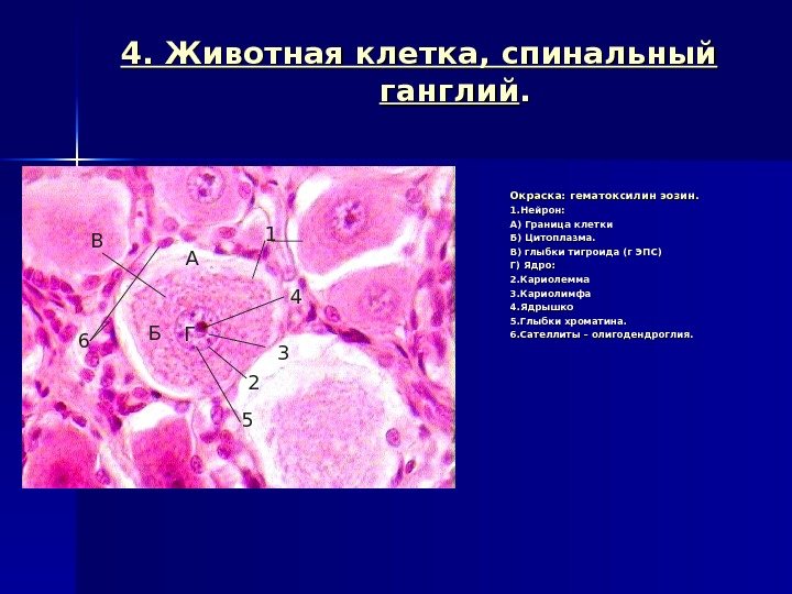 4. Животная клетка, спинальный ганглий. . Окраска: гематоксилин эозин. . 1. Нейрон: А) Граница