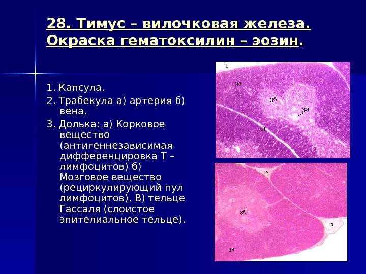 28. Тимус – вилочковая железа.  Окраска гематоксилин – эозин. . 1. Капсула. 2.