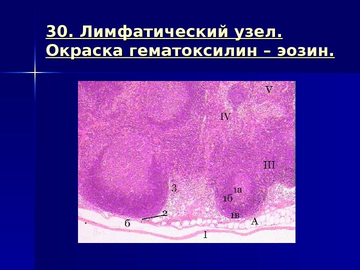 30. Лимфатический узел.  Окраска гематоксилин – эозин. 