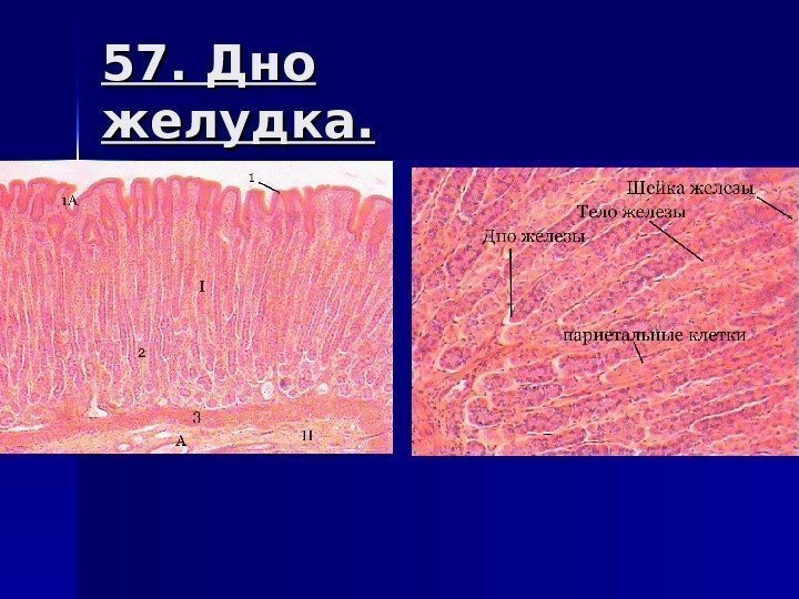 57. Дно желудка. 