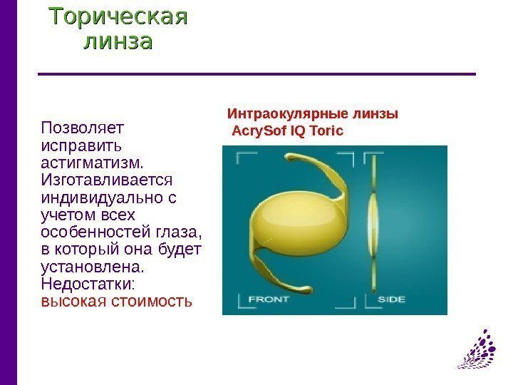 Торическая линза Позволяет исправить астигматизм.  Изготавливается индивидуально с учетом всех особенностей глаза, 