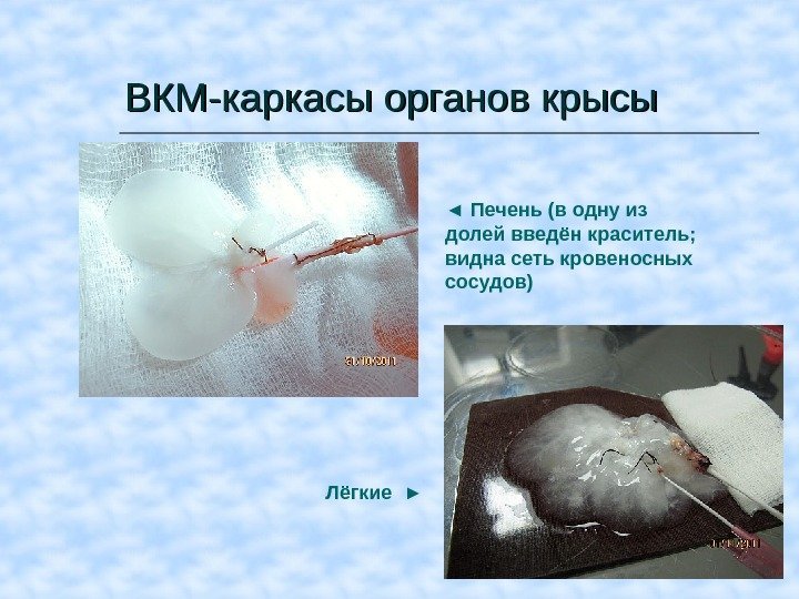ВКМВКМ -- каркасы органов крысы ◄  Печень (в одну из долей введён краситель;