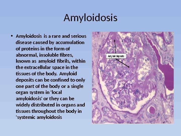 Amyloidosis • Amyloidosis is a rare and serious disease caused by accumulation of proteins