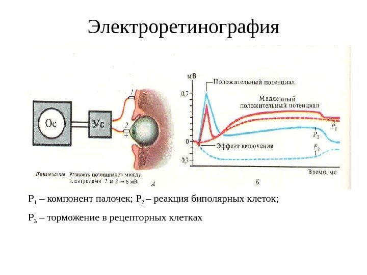   Электроретинография Р 1 – компонент палочек; Р 2 – реакция биполярных клеток;