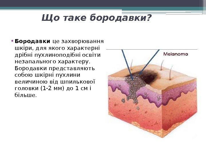 Що таке бородавки?  • Бородавки це захворювання шкіри, для якого характерні дрібні пухлиноподібні