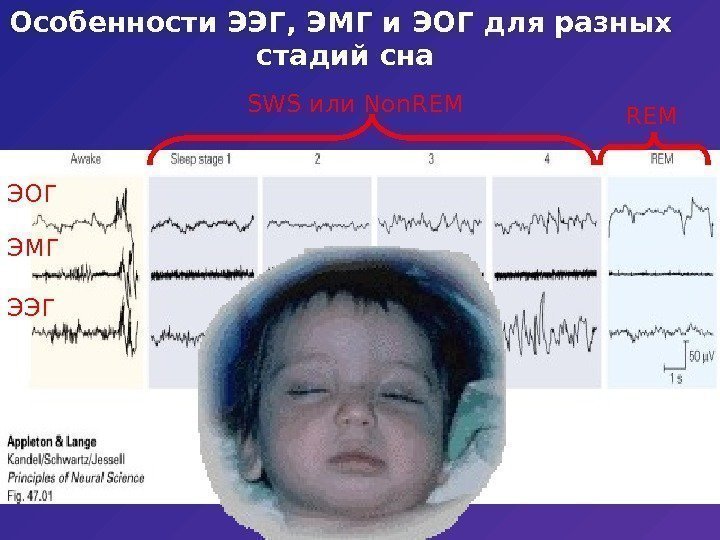   Особенности ЭЭГ, ЭМГ и ЭОГ для разных стадий сна SWS или Non.