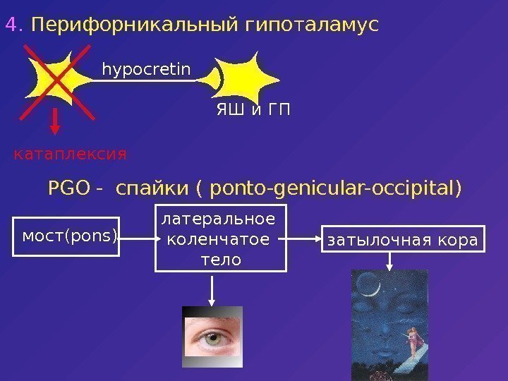   PGO -  спайки ( ponto-genicular-occipital) мост( pons) латеральное  коленчатое 