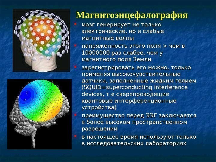Магнитоэнцефалография мозг генерирует не только электрические, но и слабые магнитные волны напряженность этого поля