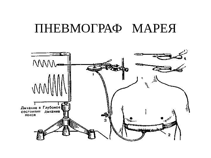   ПНЕВМОГРАФ  МАРЕЯ 