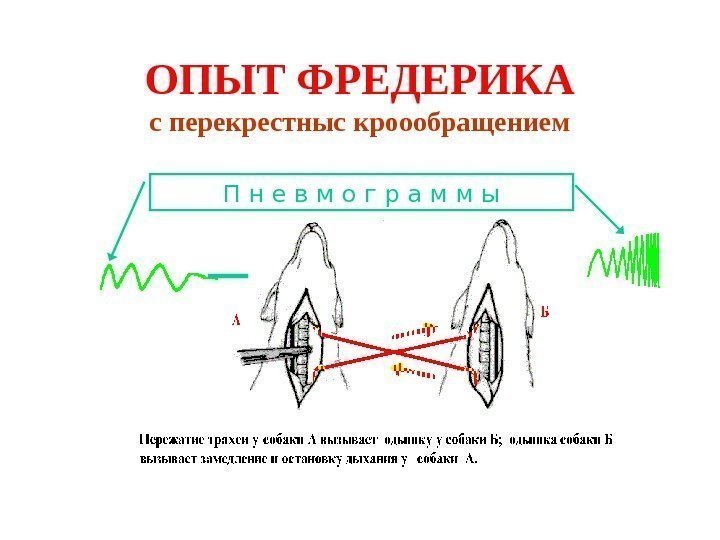   ОПЫТ ФРЕДЕРИКА с перекрестныс кроообращением П н е в м о г