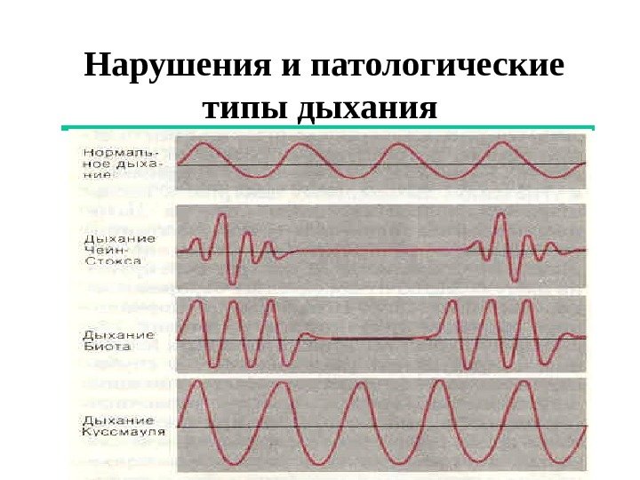  Нарушения и патологические типы дыхания 