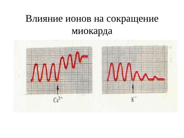   Влияние ионов на сокращение миокарда 