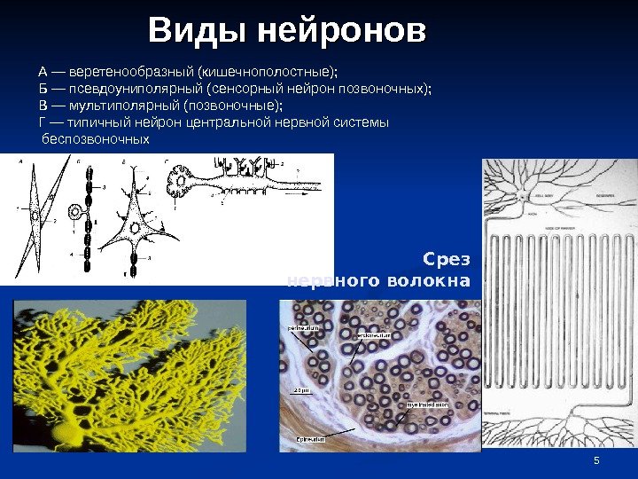 5 Виды  нейронов А — веретенообразный (кишечнополостные); Б — псевдоуниполярный (сенсорный нейрон позвоночных);