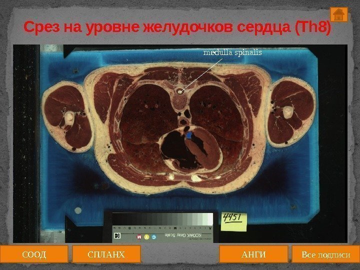 Срез на уровне желудочков сердца (Th 8) humerus medulla spinalis СООД АНГИСПЛАНХ Все подписи