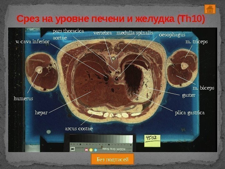 Срез на уровне печени и желудка (Th 10) pars thoracica aortae v. cava inferior