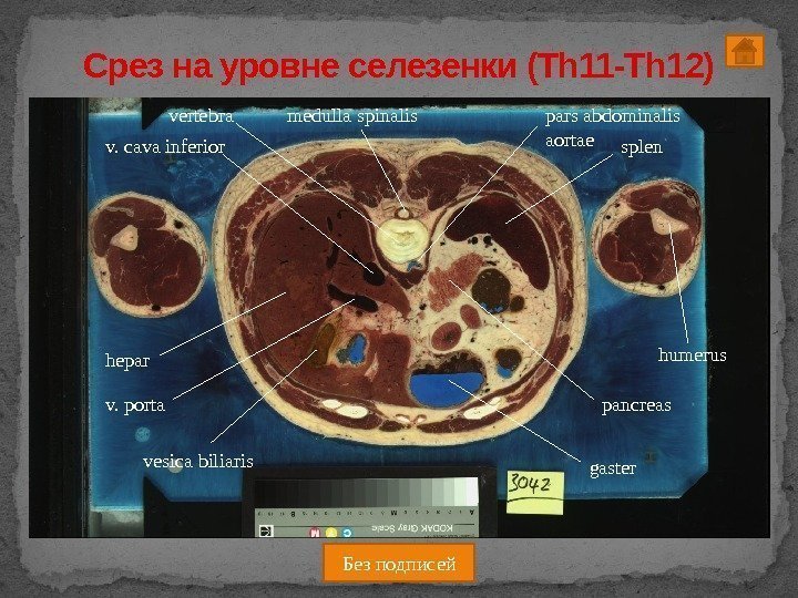 medulla spinalis pars abdominalis aortae v. cava inferior v. porta splen vesica biliaris gaster