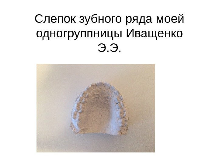   Слепок зубного ряда моей одногруппницы Иващенко Э. Э. 