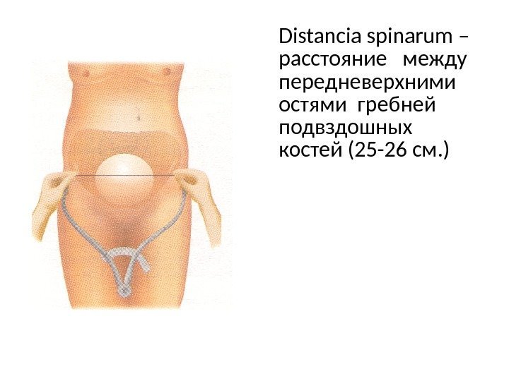 Distancia spinarum – расстояние  между передневерхними  остями гребней подвздошных костей (25 -26