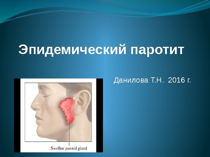 Эпидемический паротит  Данилова Т. Н.  2016 г. 