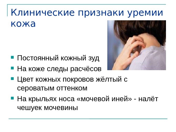 Клинические признаки уремии кожа  Постоянный кожный зуд На коже следы расчёсов Цвет кожных