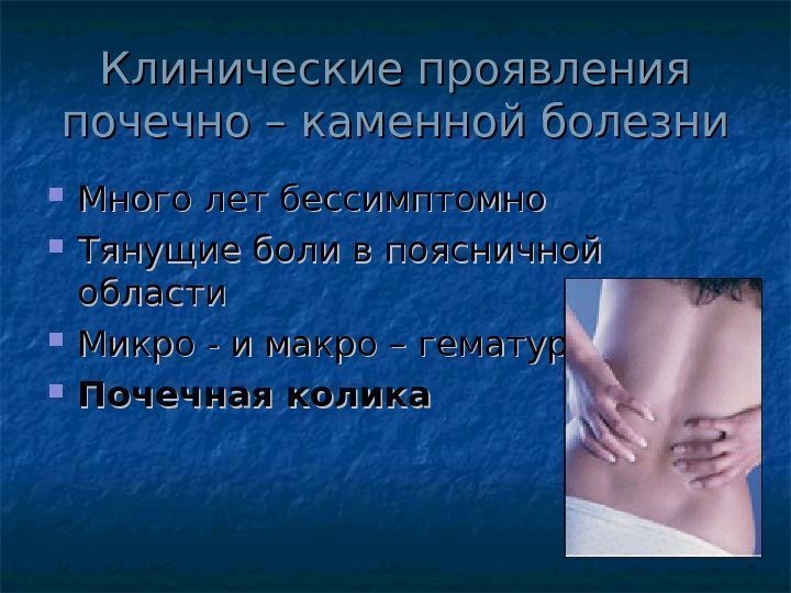 Клинические проявления почечно – каменной болезни Много лет бессимптомно Тянущие боли в поясничной области