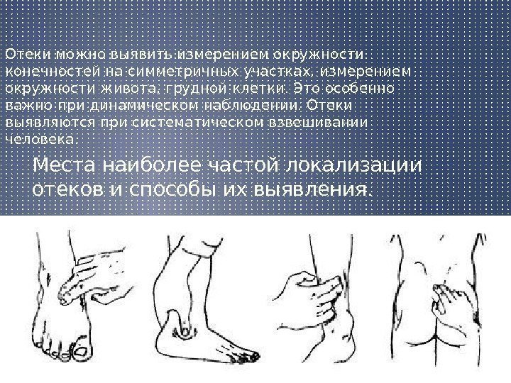 Аналог Фелодипа Не Вызывающий Отек Ног