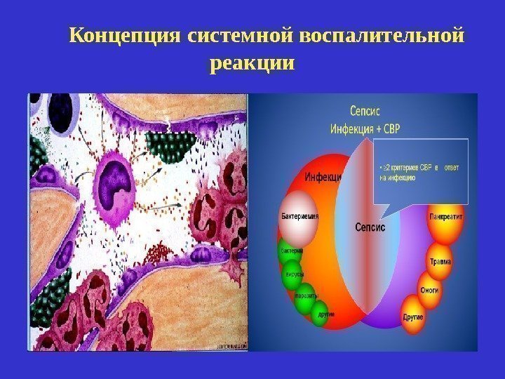  Концепция системной воспалительной реакции 