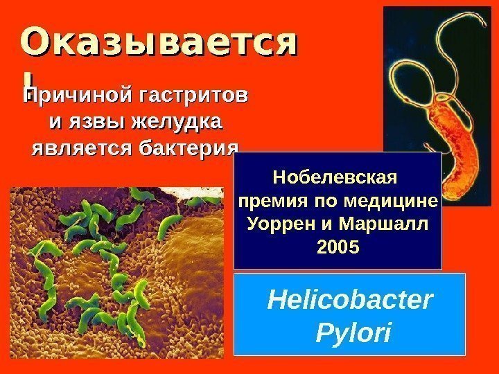 Оказывается !! Причиной гастритов и язвы желудка является бактерия Helicobacter  Pylori. Нобелевская премия
