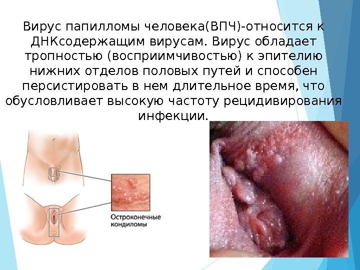 Вирус папилломы человека(ВПЧ)-относится к ДНКсодержащим вирусам. Вирус обладает тропностью (восприимчивостью) к эпителию нижних отделов