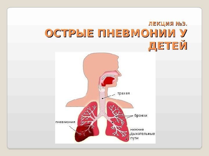 ЛЕКЦИЯ № 3. ОСТРЫЕ ПНЕВМОНИИ У ДЕТЕЙ 